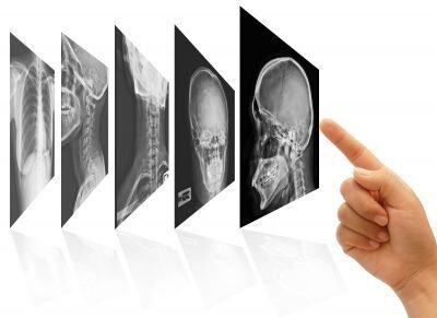 Benefits of Implementing EHR for Radiologists