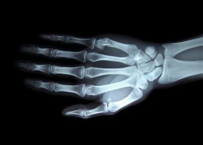 How Rheumatologists Can Benefit From EHR