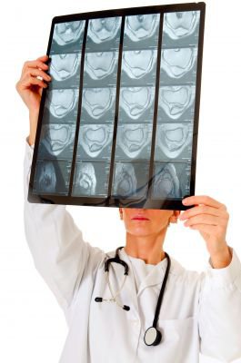 Streamline Radiology Workflow with Radiology Information Systems