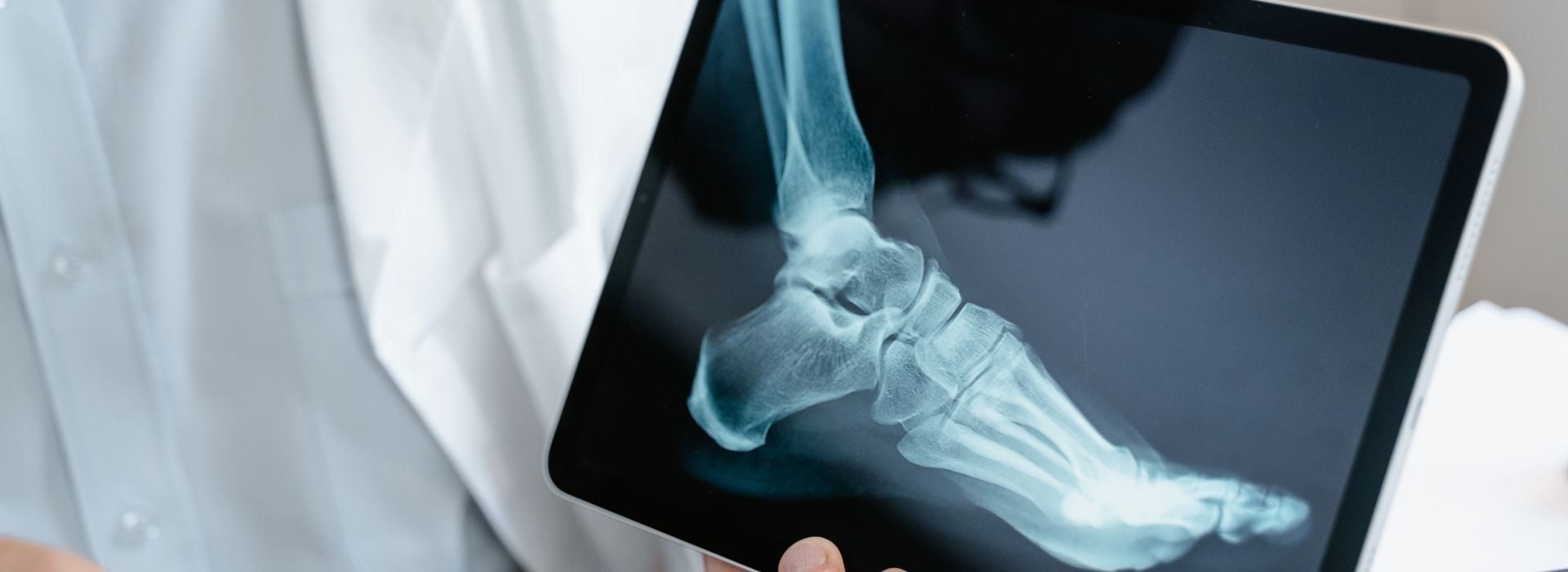 Orthopedic Billing Complexity: Managing Multi-Code Encounters and Implant Charges