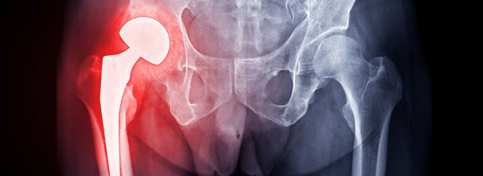 Orthopedic Medical Billing: The Complete Guide for Practices