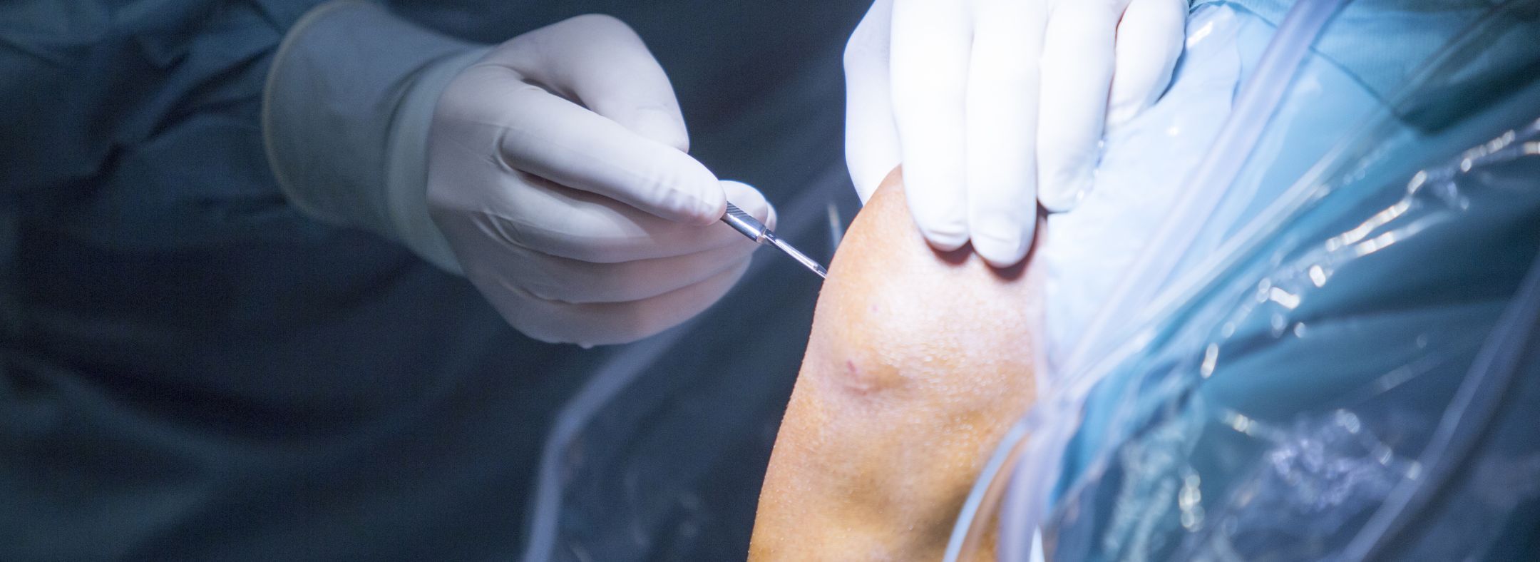 Orthopedic Surgery Billing: Codes, Challenges, and Best Practices