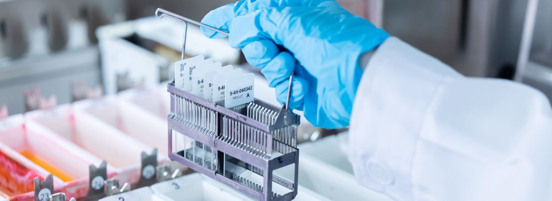 Pathology Lab Billing: Navigating CPT, TC/PC Splits, and Payer Audits in 2026